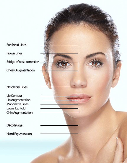 fillers sites