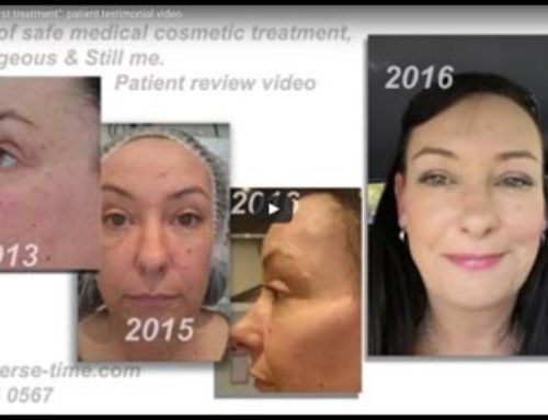 Ageing well: 7 years since my first treatment